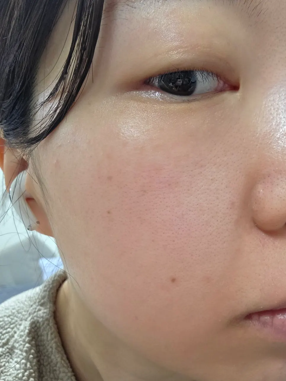 Record photo of skin after using the ampoule