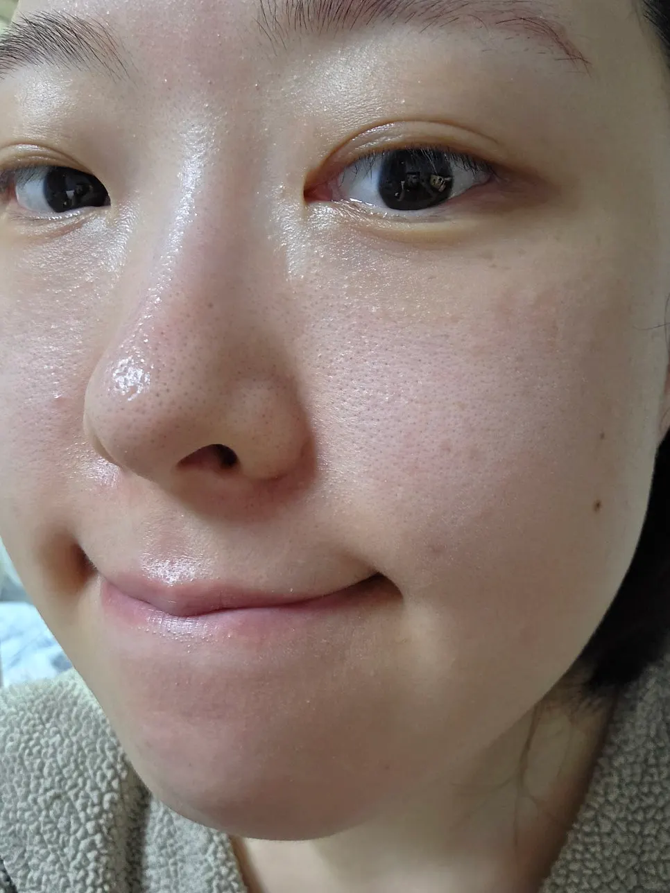 Record photo of skin after using the ampoule