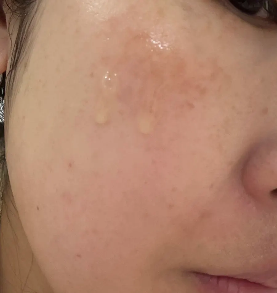 토너 다음 단계 앰플 사용 모습