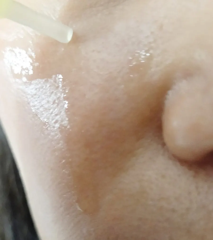 앰플을 얼굴에 사용하는 방법