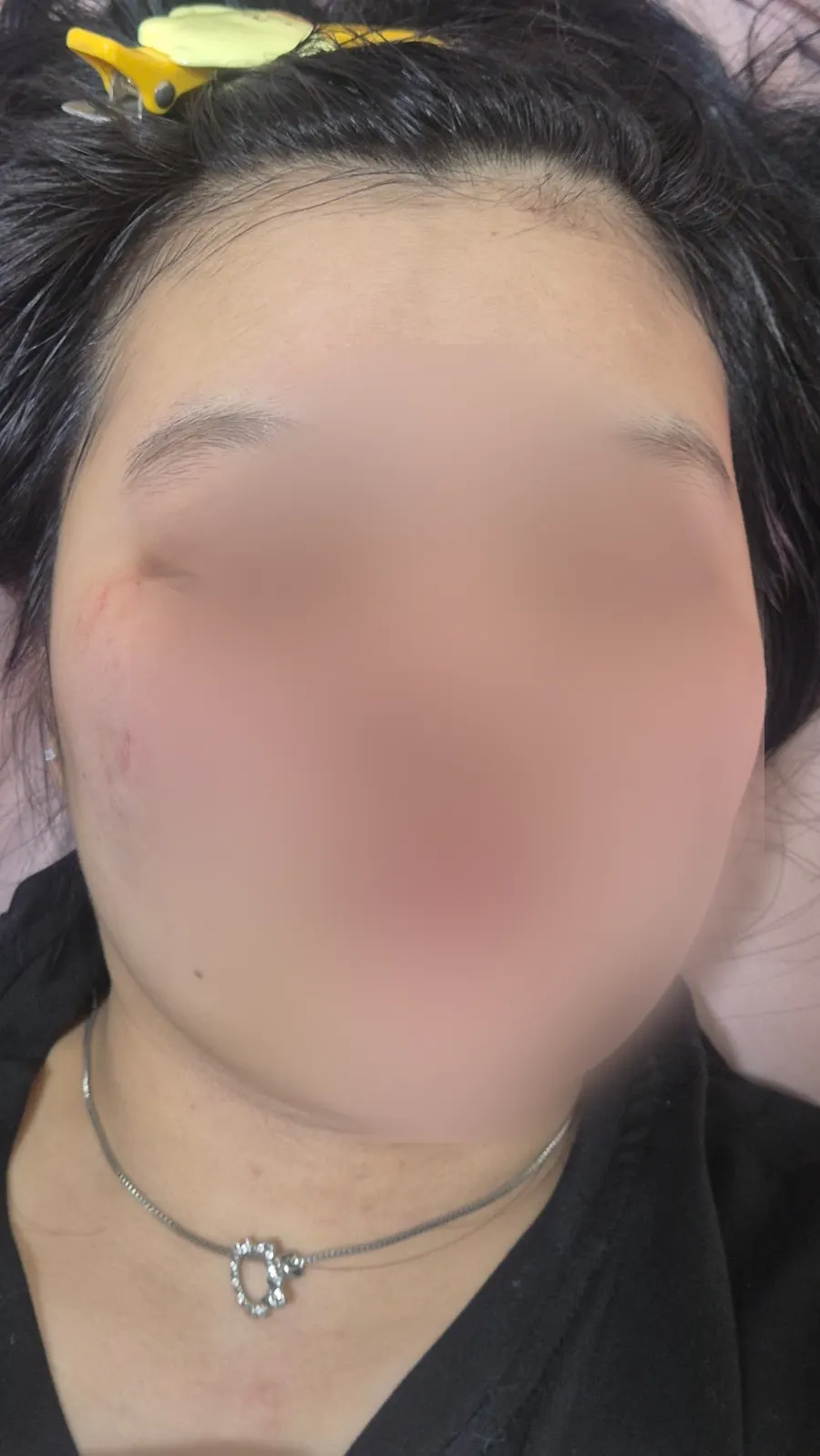 アンプルの成分と保湿感を説明する画像