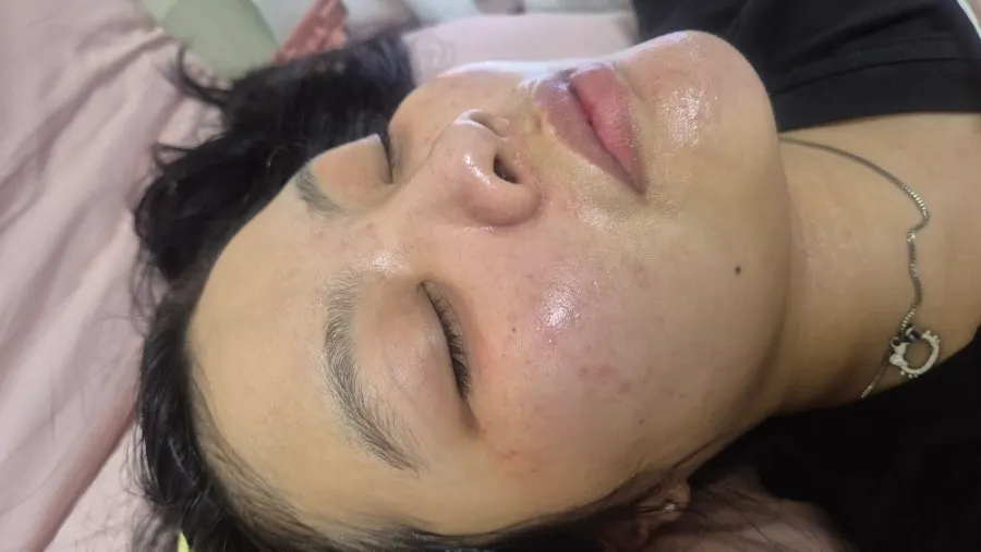2주간 아침저녁 사용한 피부톤 변화