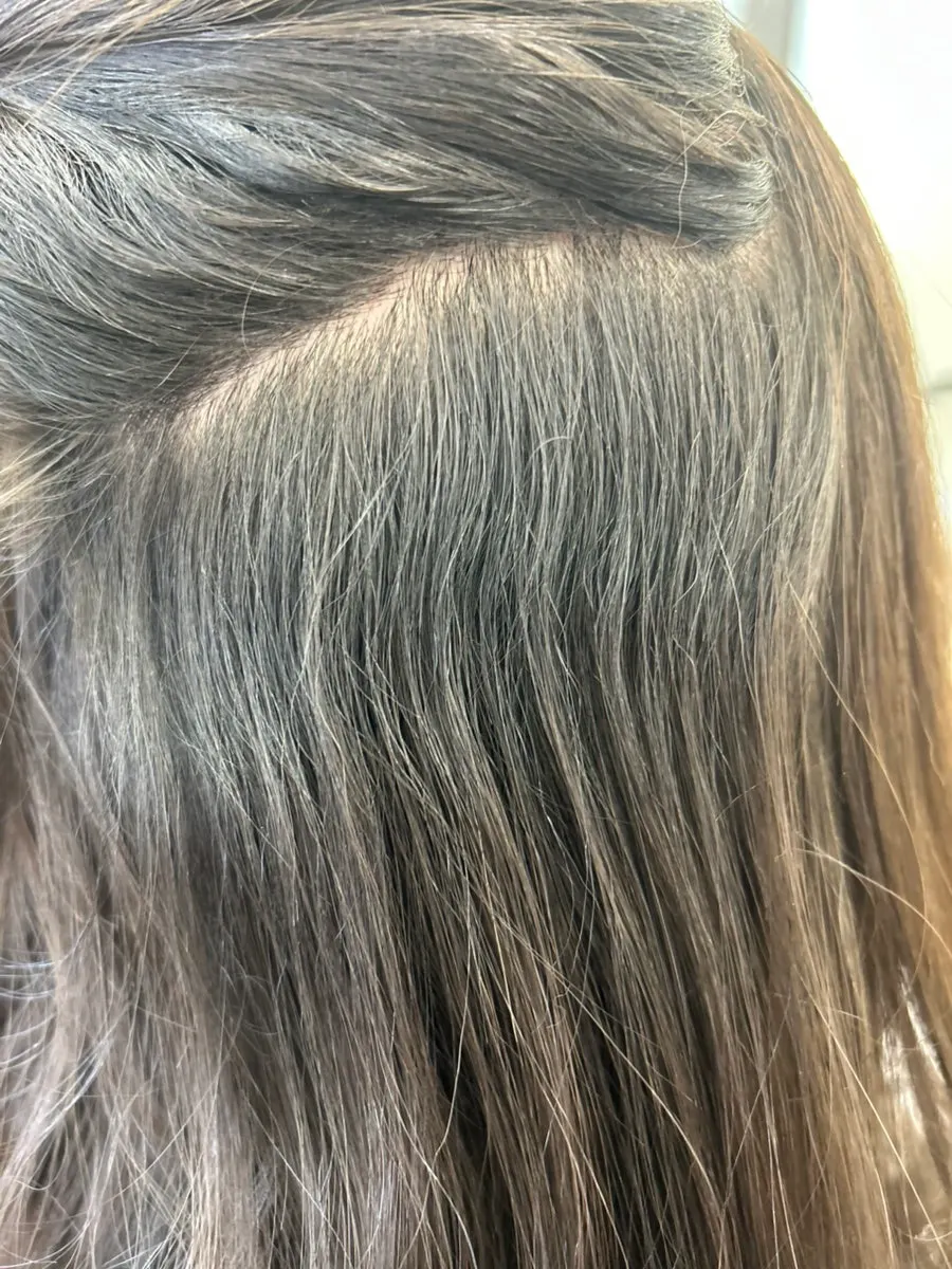 Flat, volumeless hair before treatment