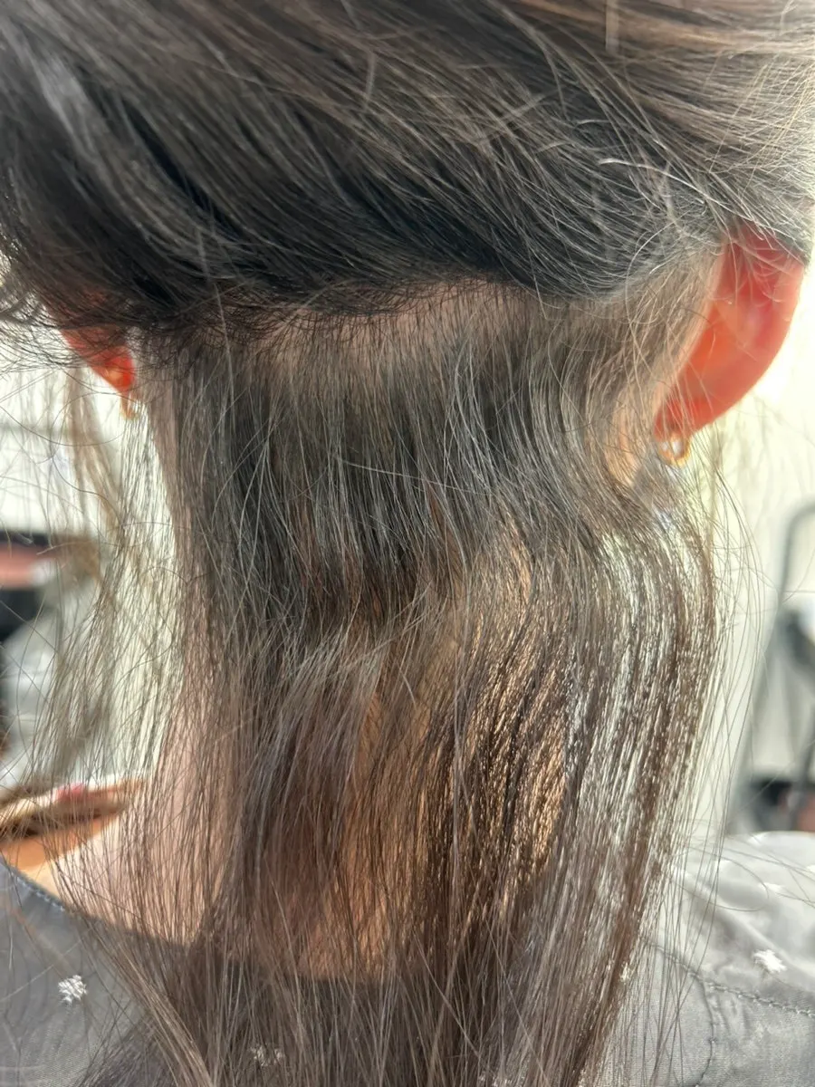 Pre-treatment hair check during consultation at Momentium