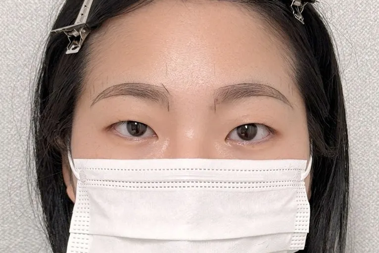 Shaping the eyebrow design during the procedure