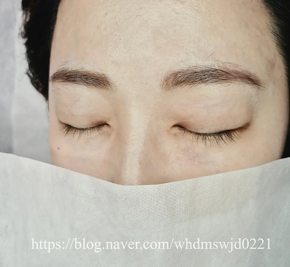 Eyelash extension before-and-after photo