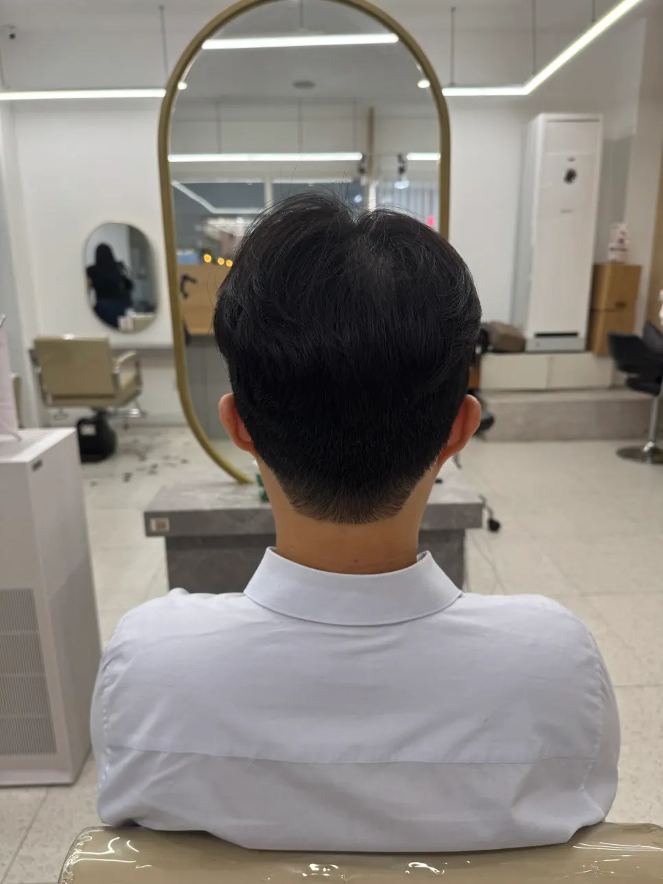 시술 후 정수리 볼륨이 살아난 정면 모습