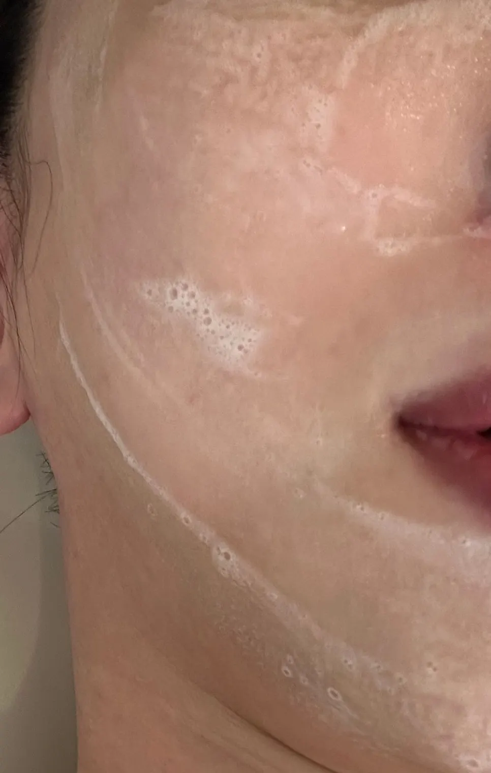 Face with small bumps before treatment
