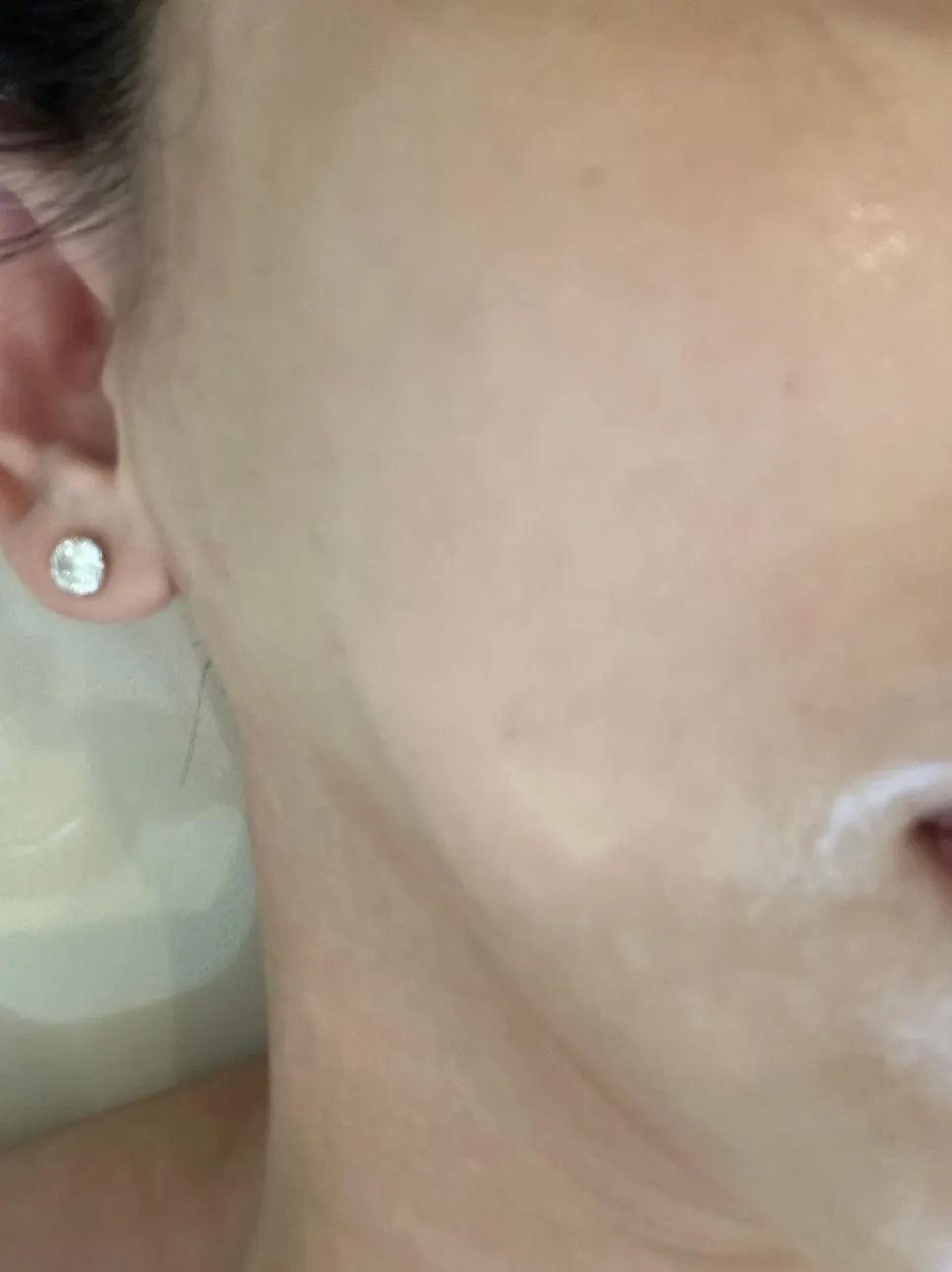 Skin looking moisturized after treatment