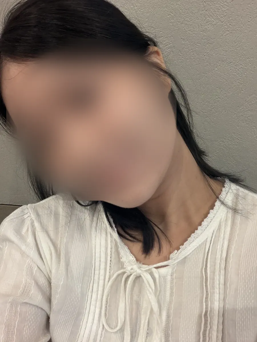 Brown color that came up more one week later