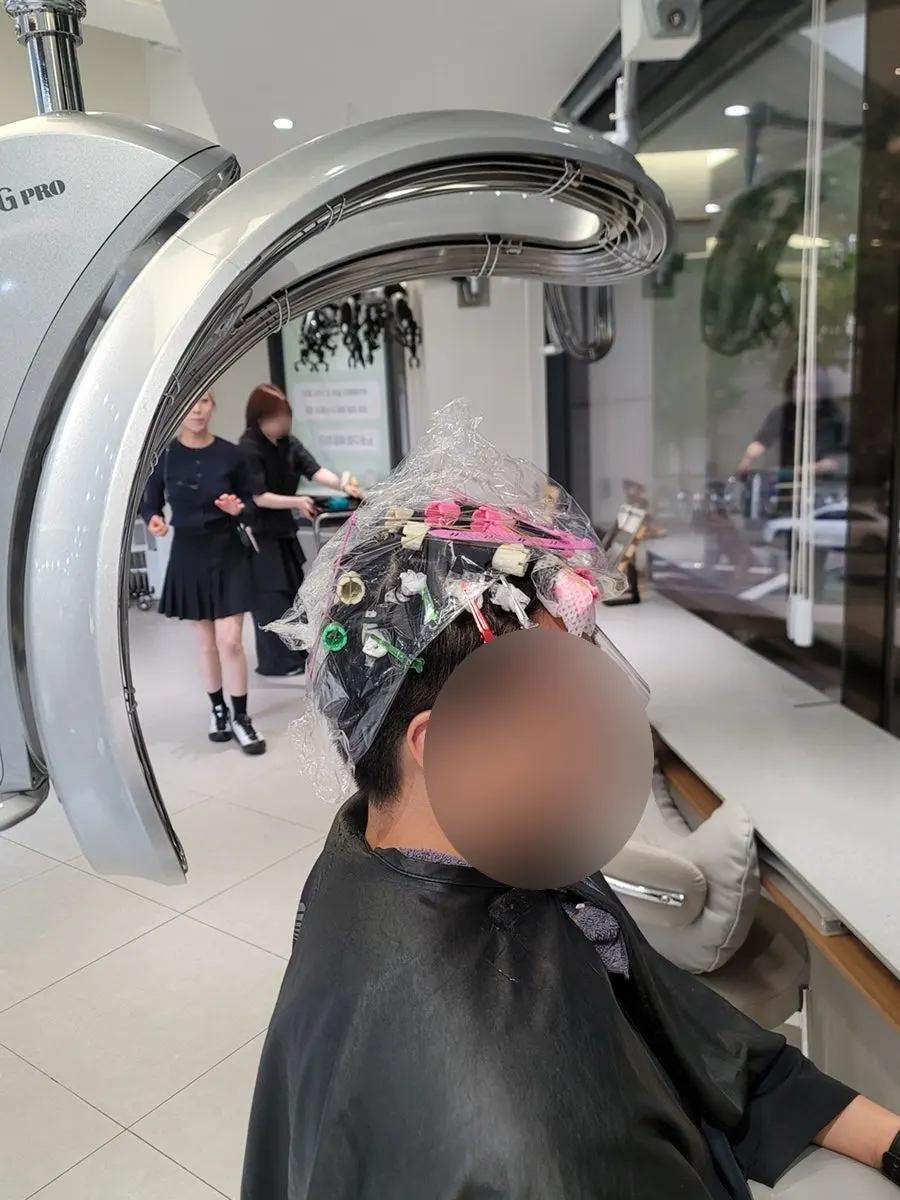 Men's hair before treatment showing floating side hair concern