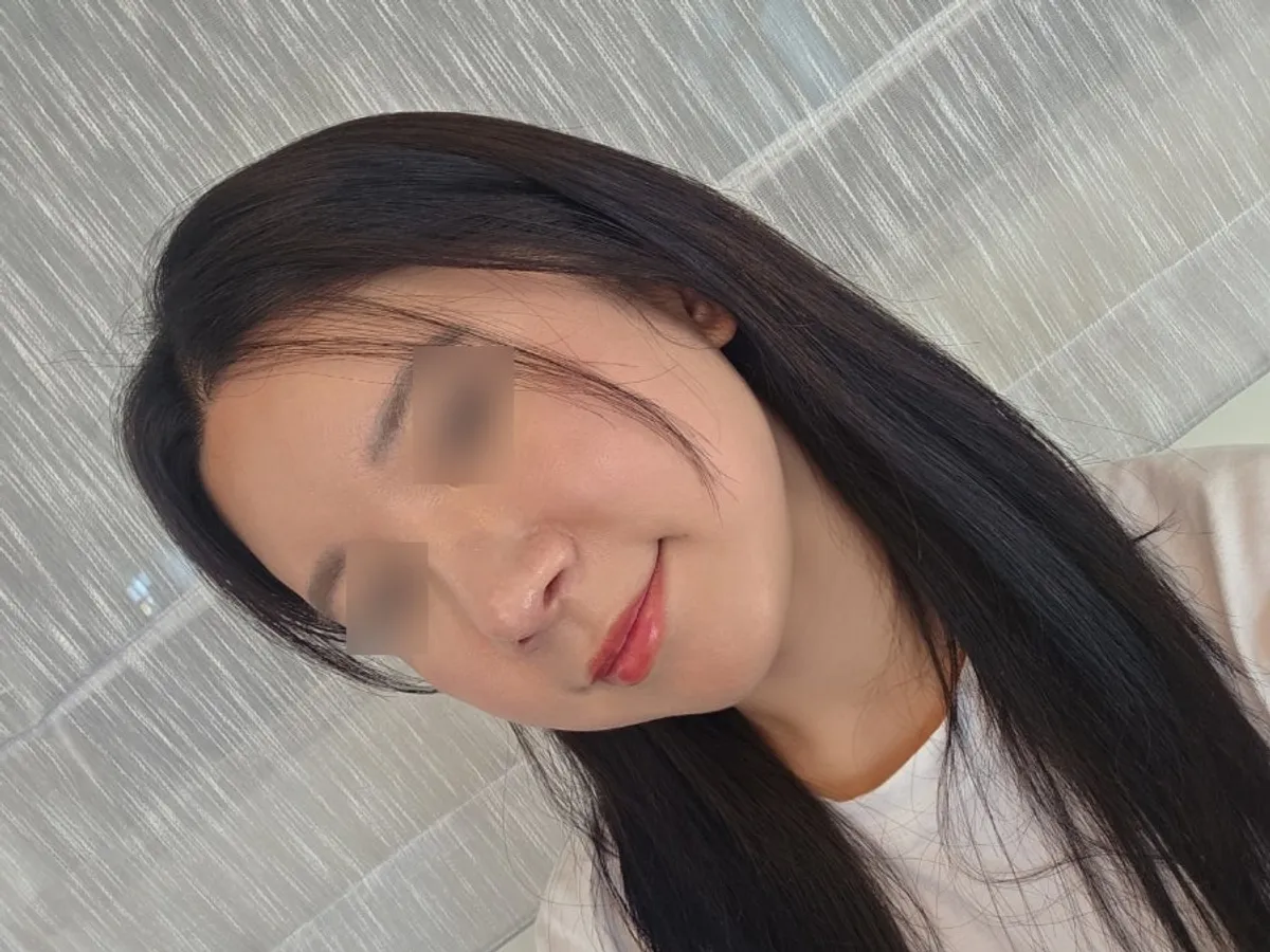 Brightened skin texture after the treatment