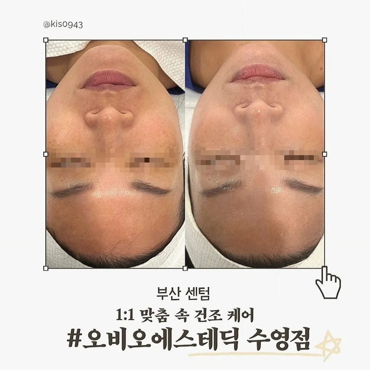 오비오 에스테틱 수영점 피부관리 대표 이미지