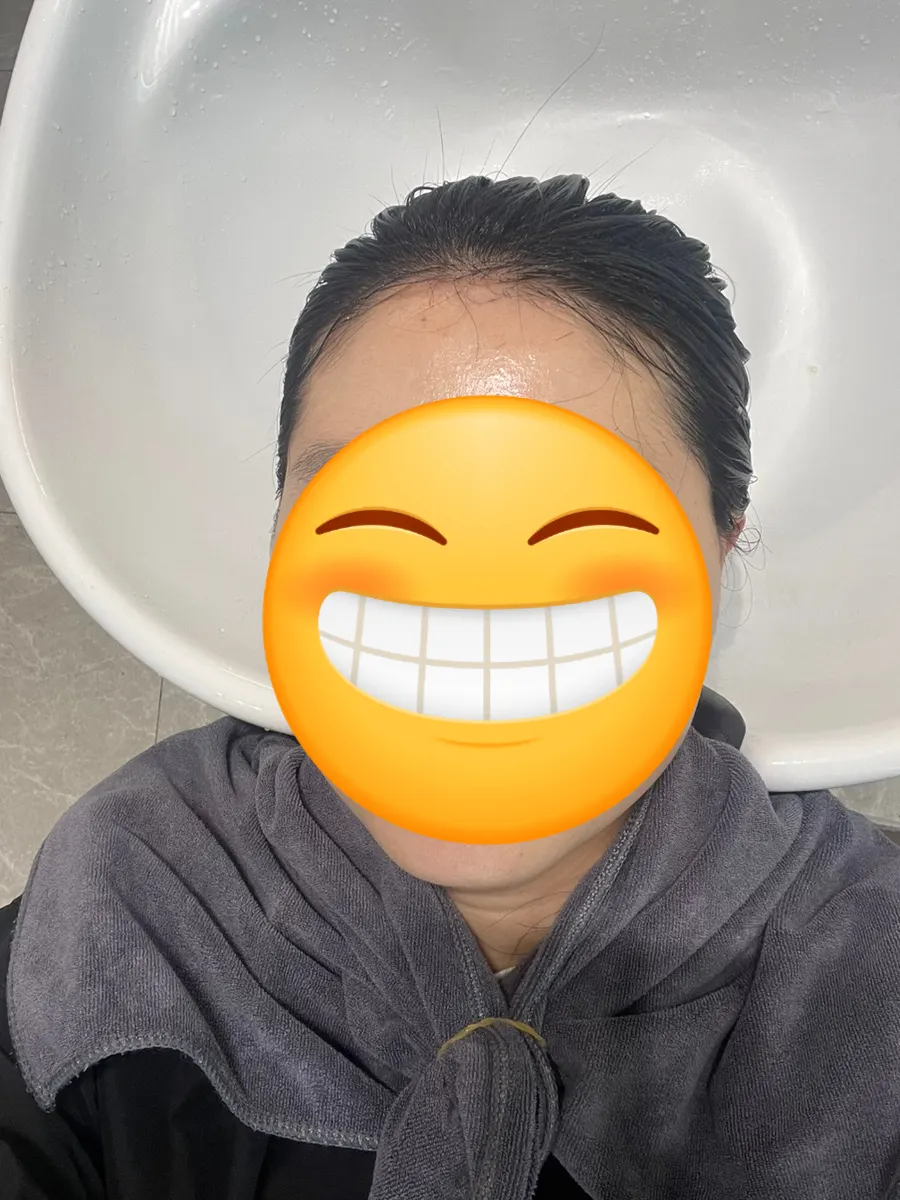 Before-and-after comparison of hair condition after the clinic treatment