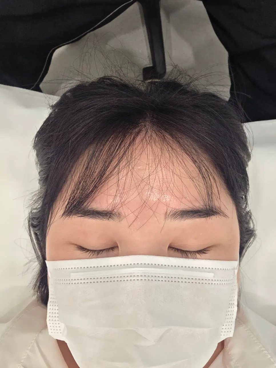 속눈썹펌 시술 전 비포 눈매