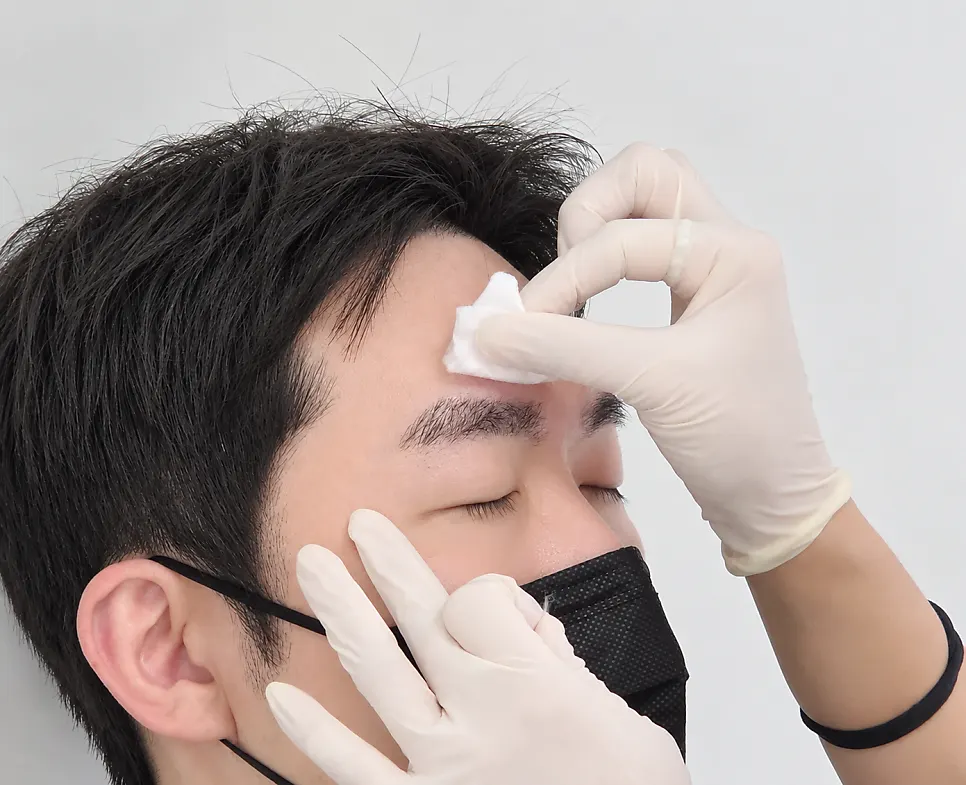 Wiping off the numbing cream before consultation and design
