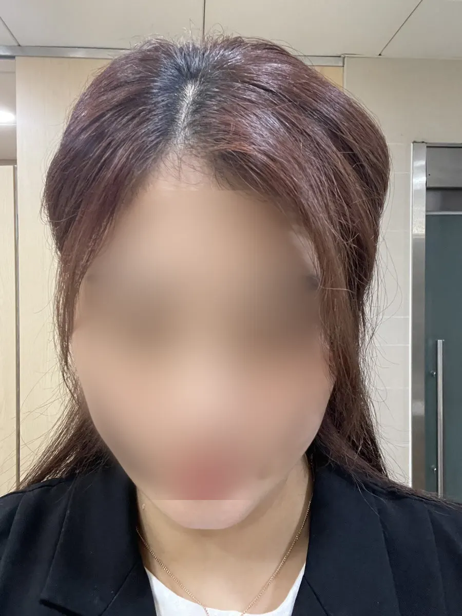 염색 전 검은 머리가 올라온 모발 상태