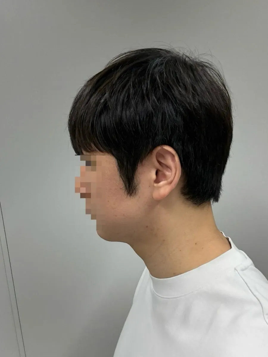 Side profile showing left-right asymmetry before the service
