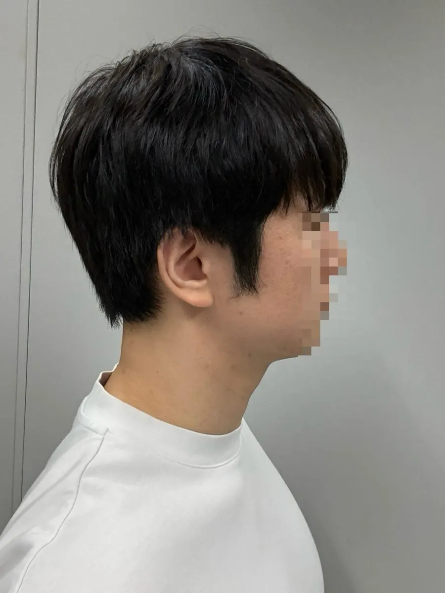 Back view of thin, unruly hair before the service