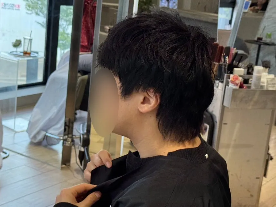 시술 전 덥수룩한 헤어 뒷모습