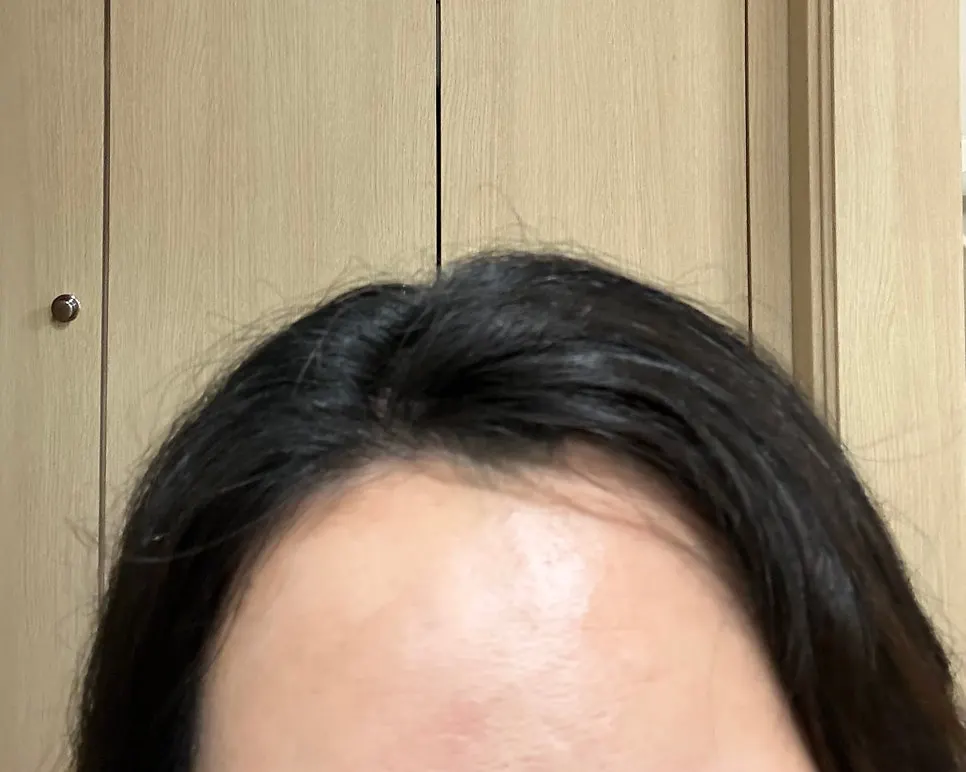 Before and after comparison of the volume straightening