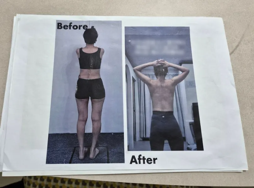 Post comparing the owner's before and after results