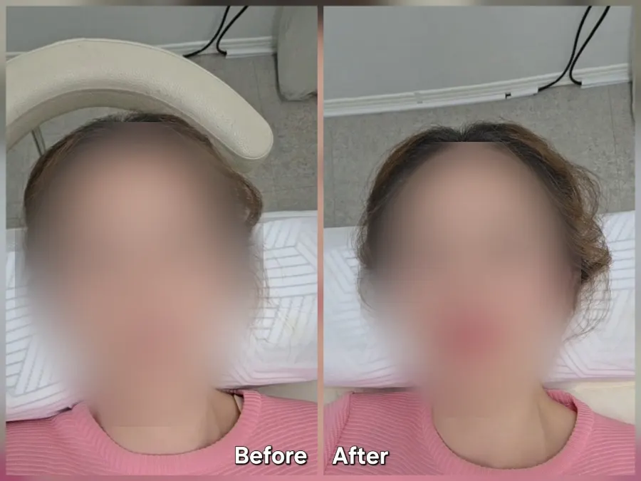 Comparison of facial impression with pink lip color