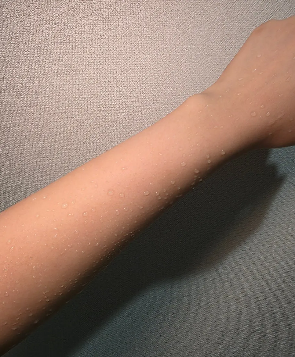 Water droplets on skin after showering