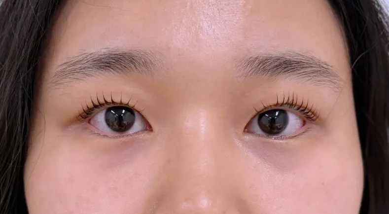 Eyes after the Sinjungdong Station lash perm