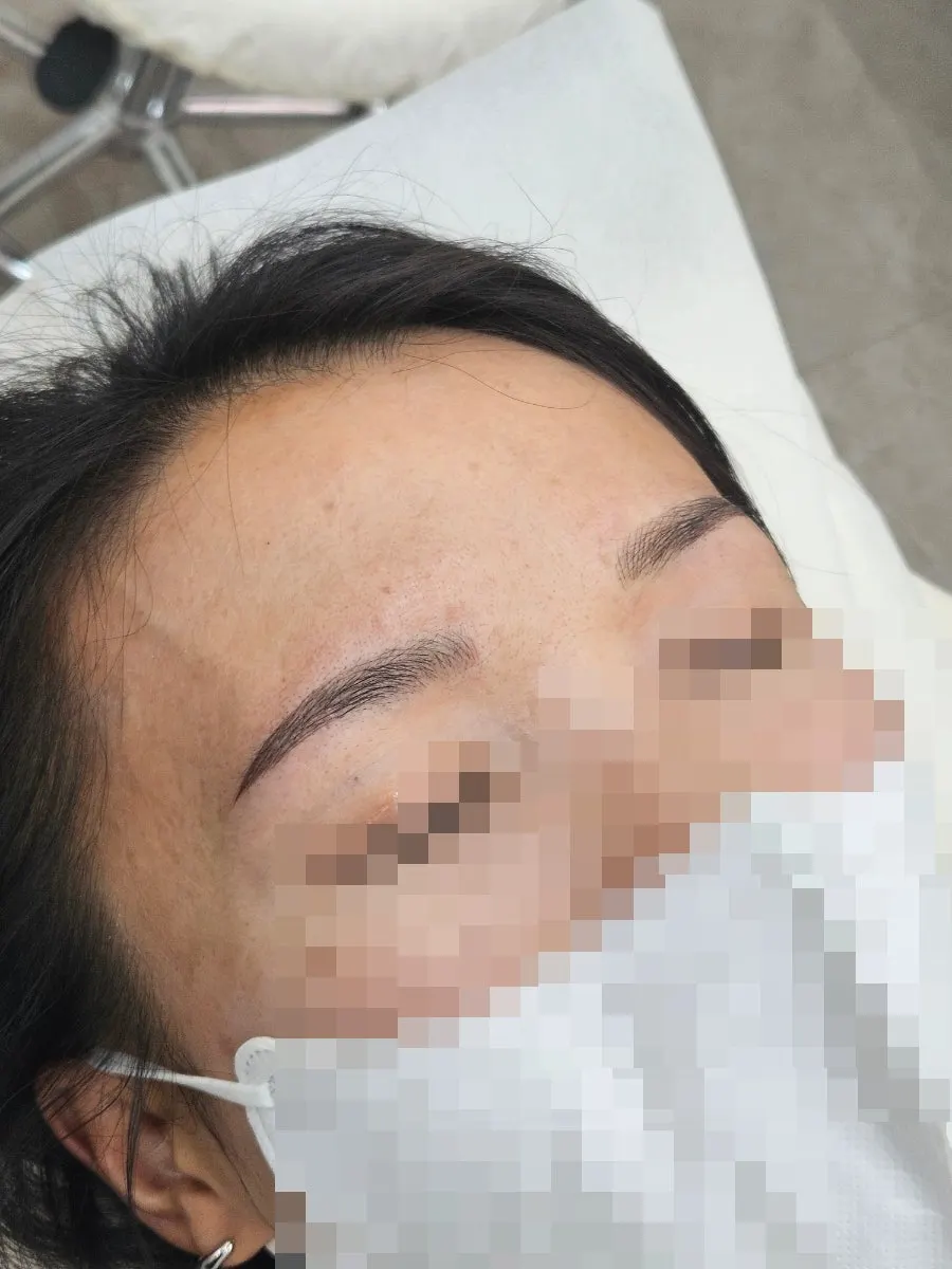 콤보눈썹 시술 직후 눈썹