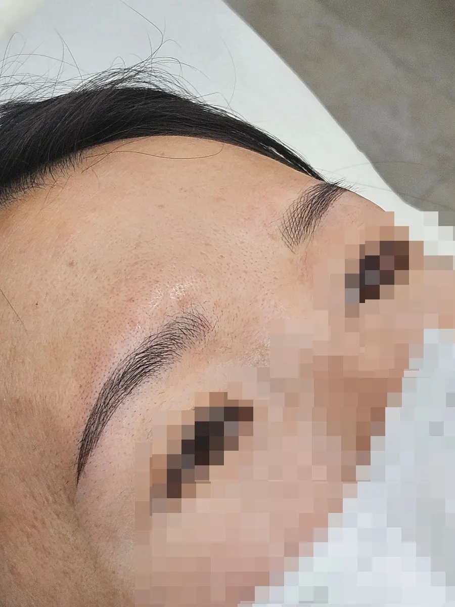 시술 직후 대칭이 맞춰진 눈썹