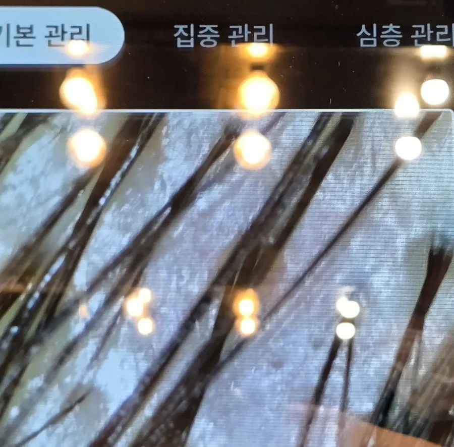 두피 진단기 검사 장면