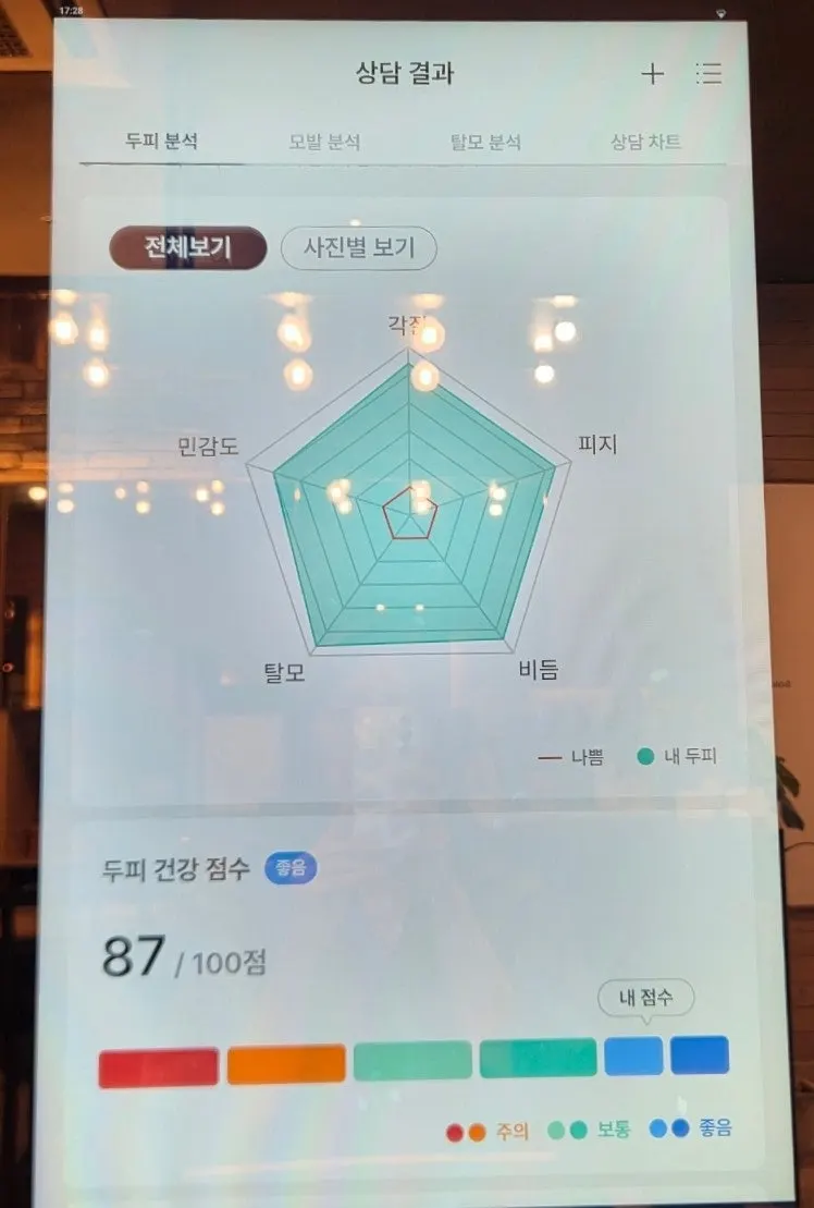 모니터에 나온 두피 검사 화면