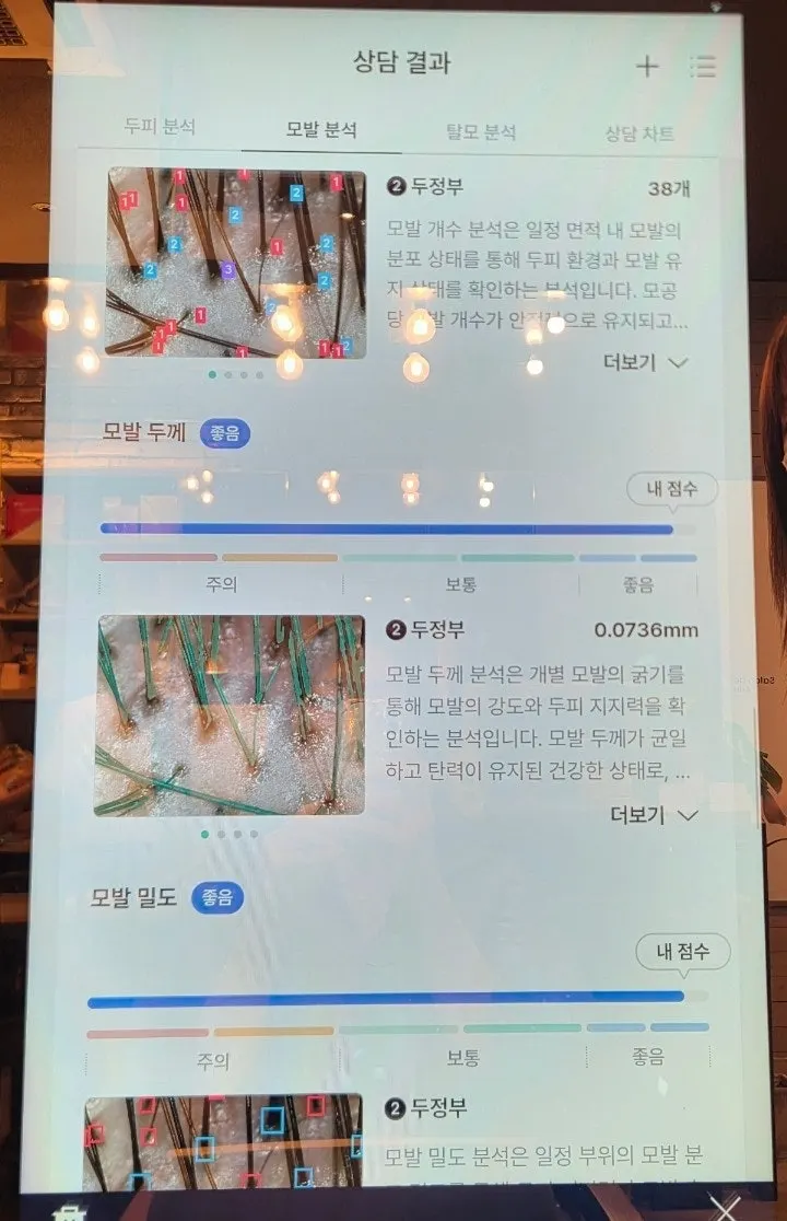 붉은 두피 상태 진단 화면