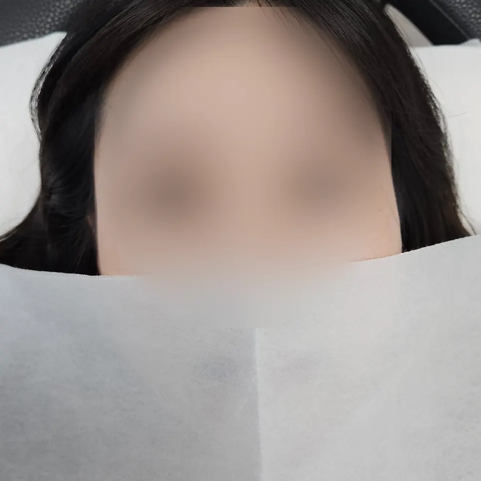 시술 전 아래로 처진 속눈썹 상태