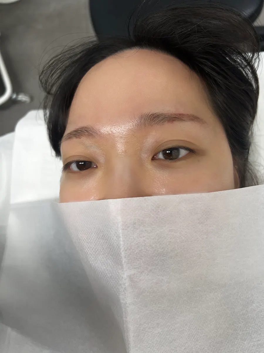 블랙클리닉펌 시술 전 속눈썹 상태