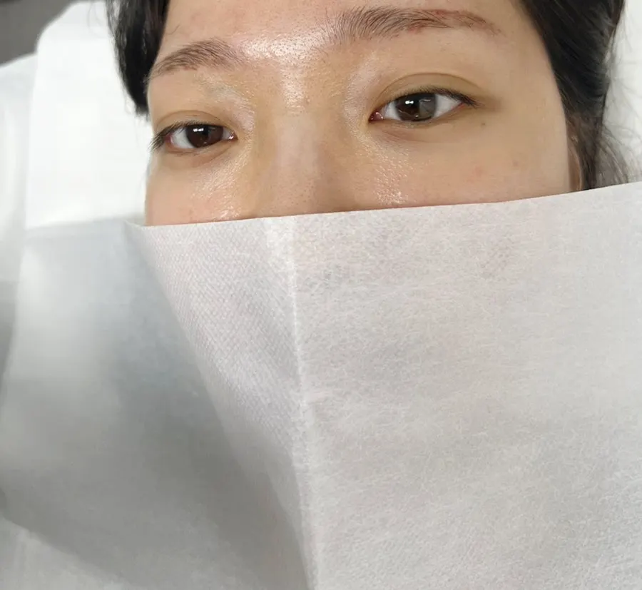 블랙클리닉펌 시술 후 컬 올라간 속눈썹