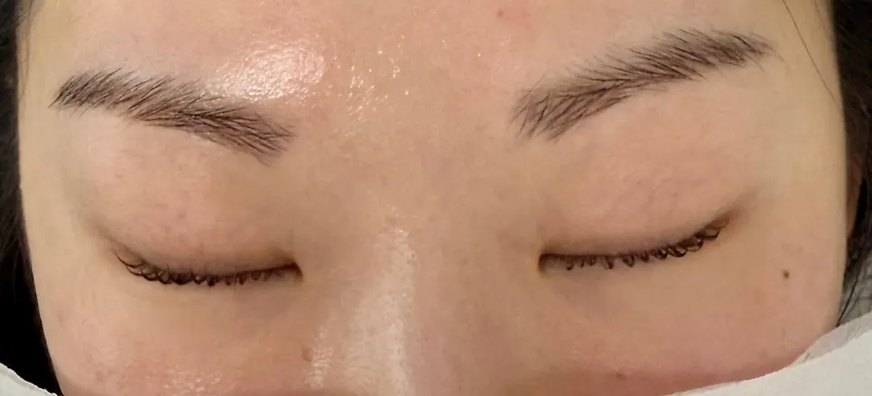 Close-up of the eye area right after the black clinic perm
