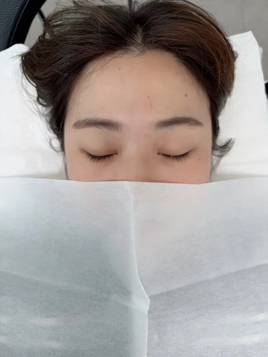 Downward-drooping lashes before the treatment