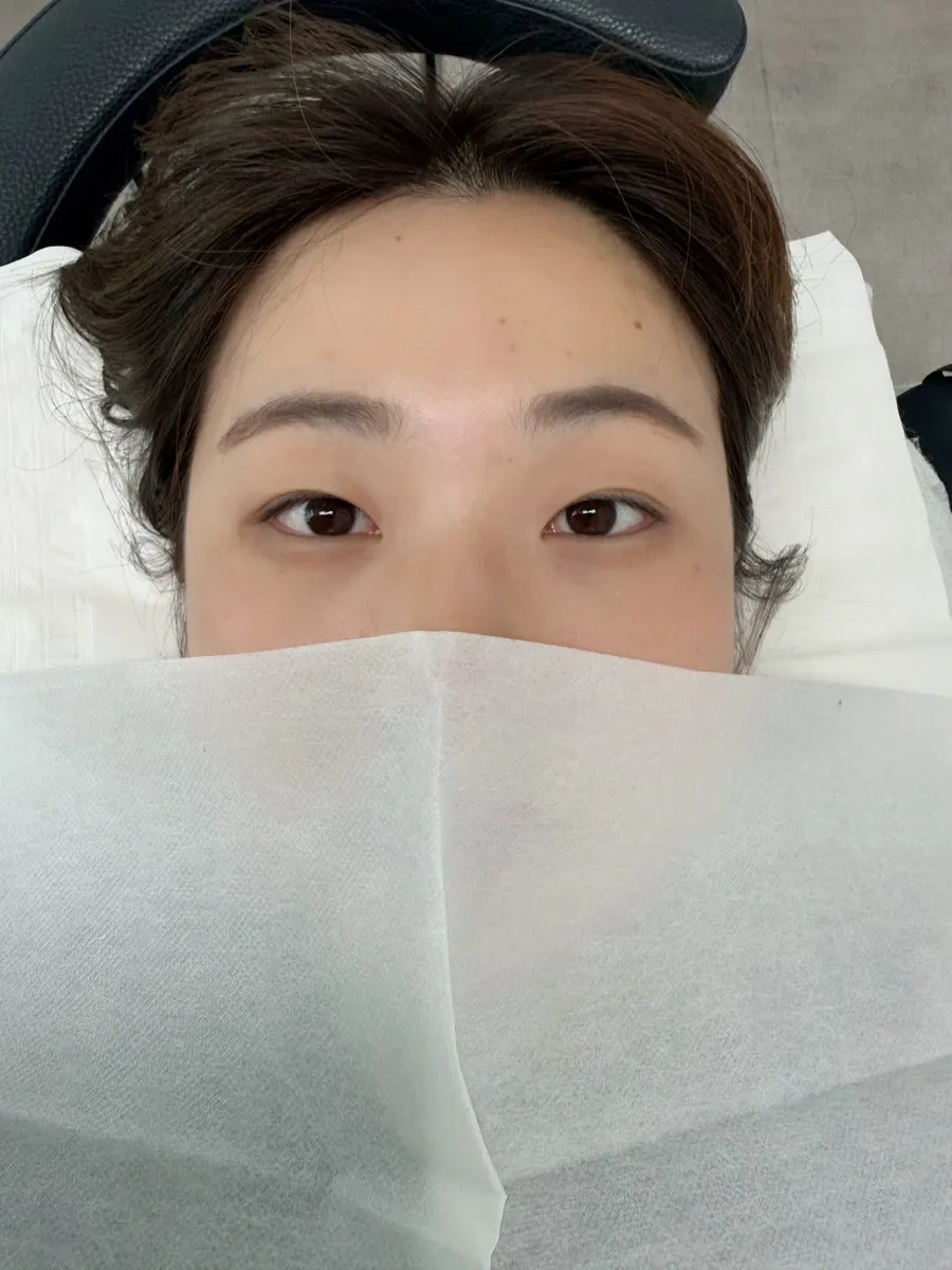 Hooded eyes before the lash perm
