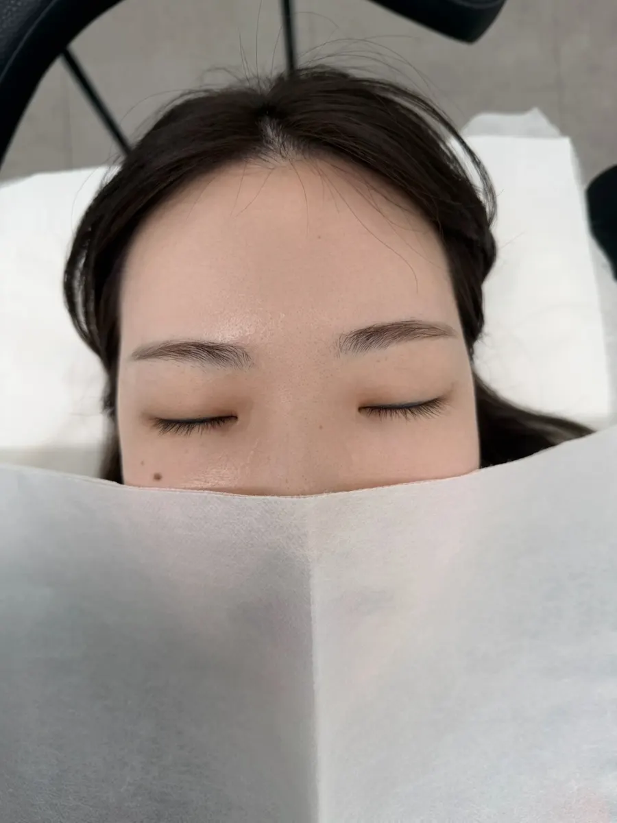 속눈썹펌 시술 전 처진 속눈썹 상태