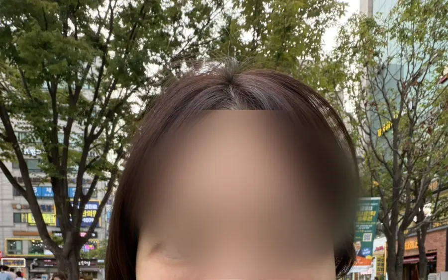 마스카라 없이도 선명해 보이는 시술 후 눈매