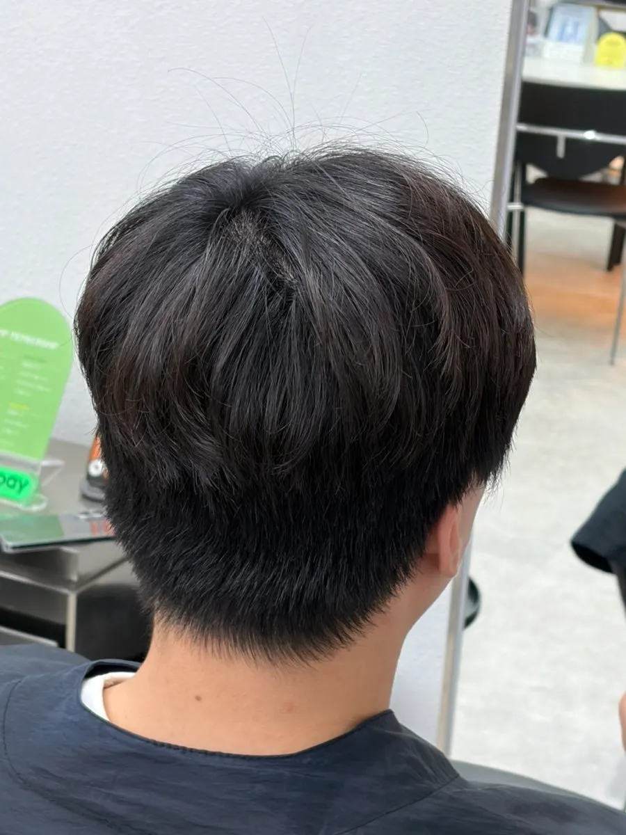 Men's hair condition before treatment