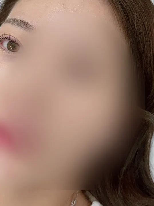 온더똘망펌 직후 정면에서 본 속눈썹 컬