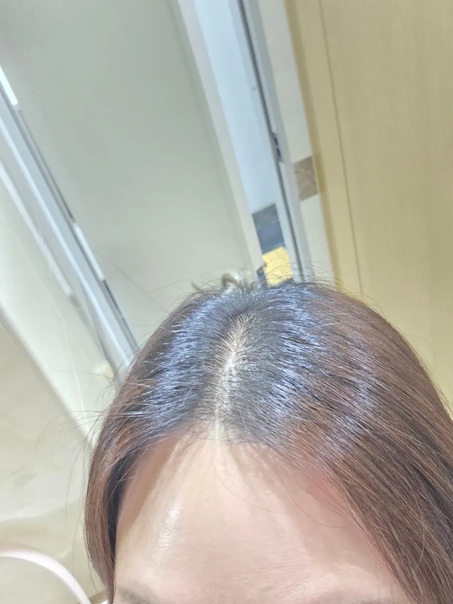 시술 전 뿌리 부분 클로즈업