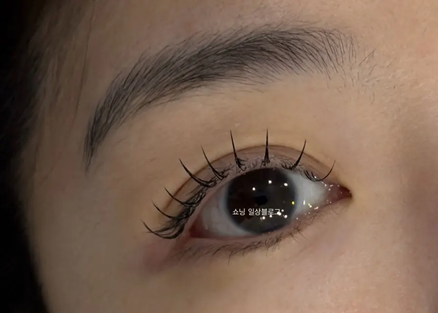 Front view of the noticeably defined eyes after the treatment