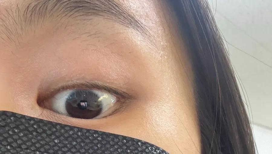 Eye area before the lash lift
