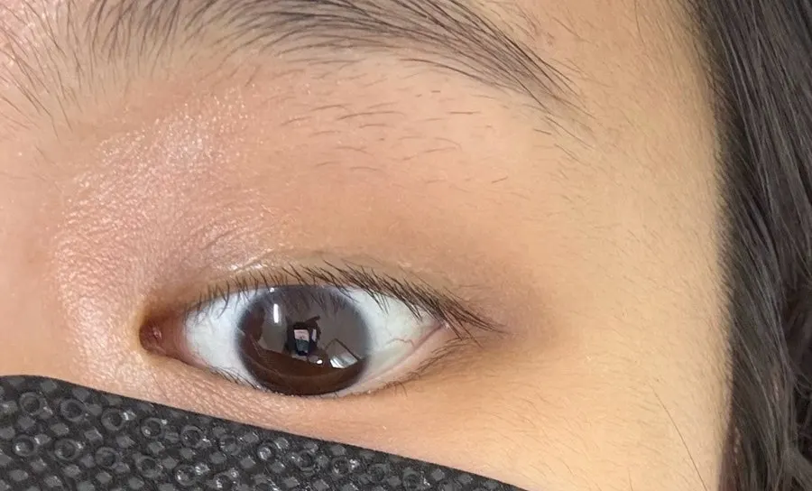 Before: downward-pointing lashes