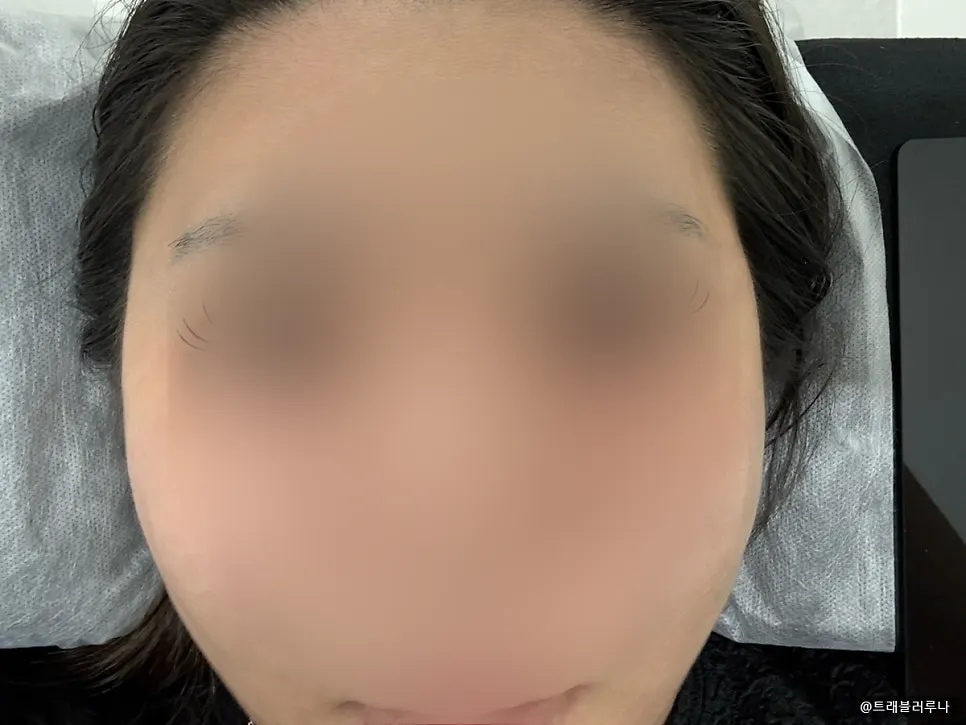 속눈썹 연장 전 비포 눈매