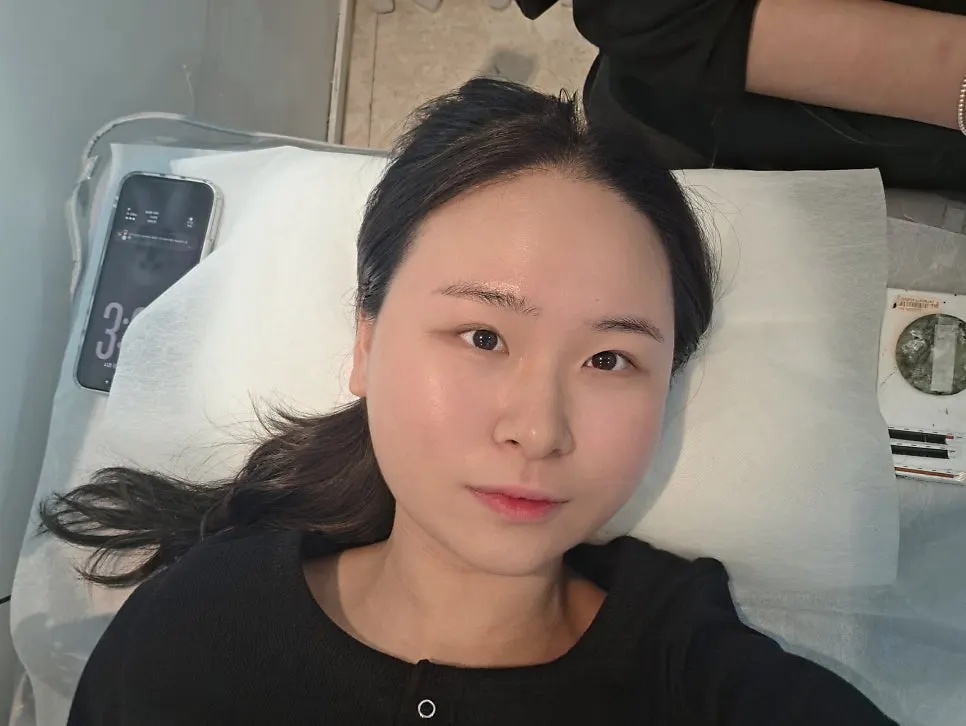 Before photo for eyelash extensions